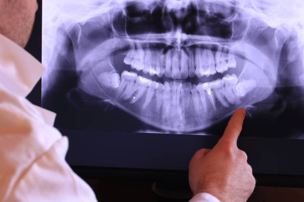 Best Urgent Tooth Repair  in East Washington, PA